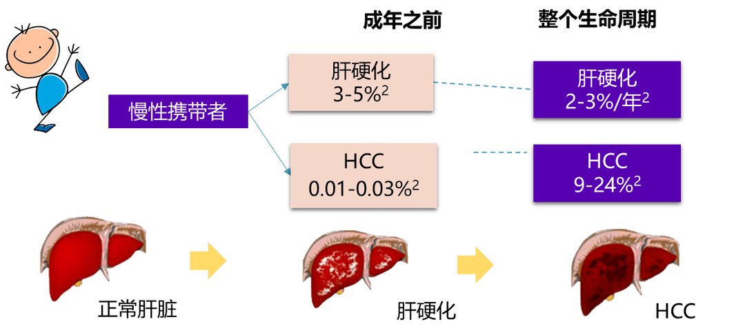 探索肝硬化治疗新趋势